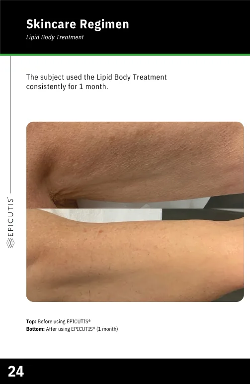 Lipid Body Treatment - Image 3