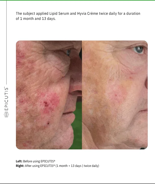 Luxury Skincare Set - Image 3