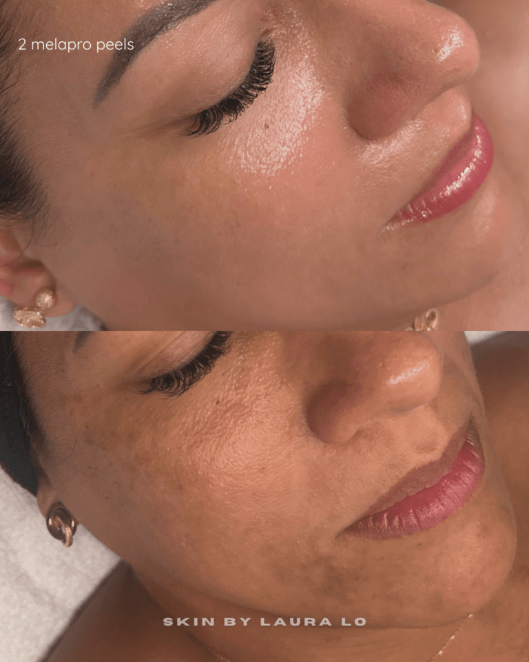 Longer Before and Afters (1)