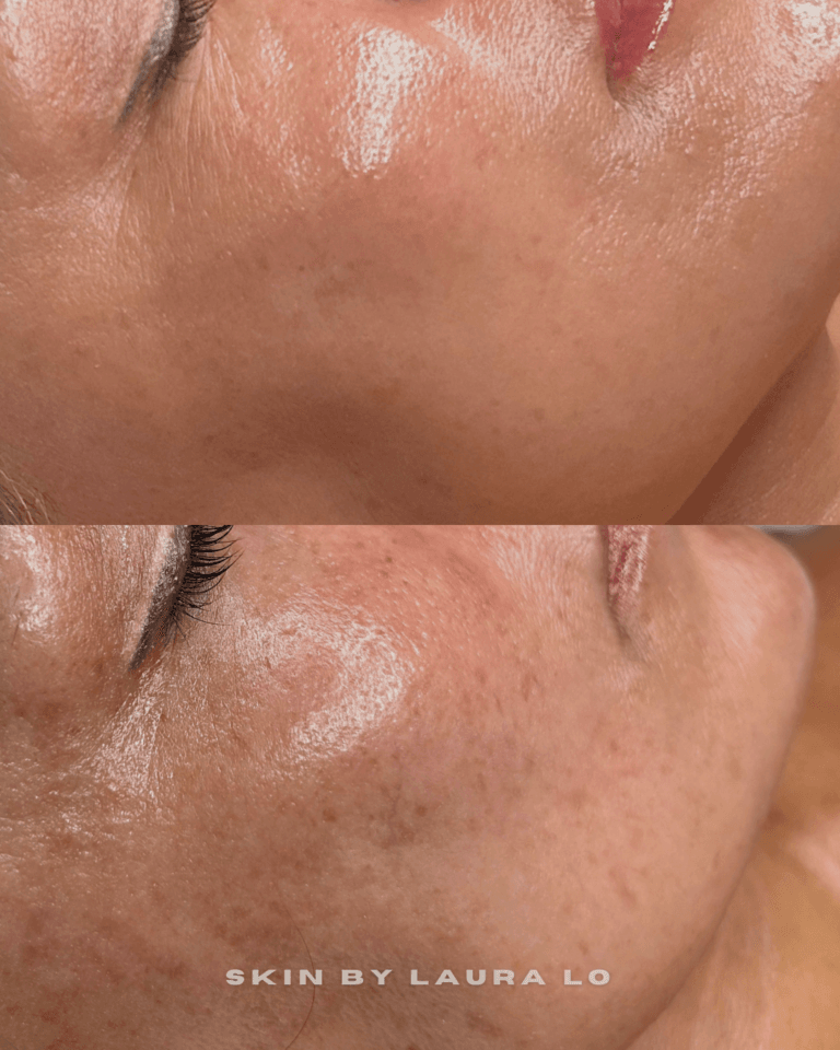 Longer Before and Afters (10)