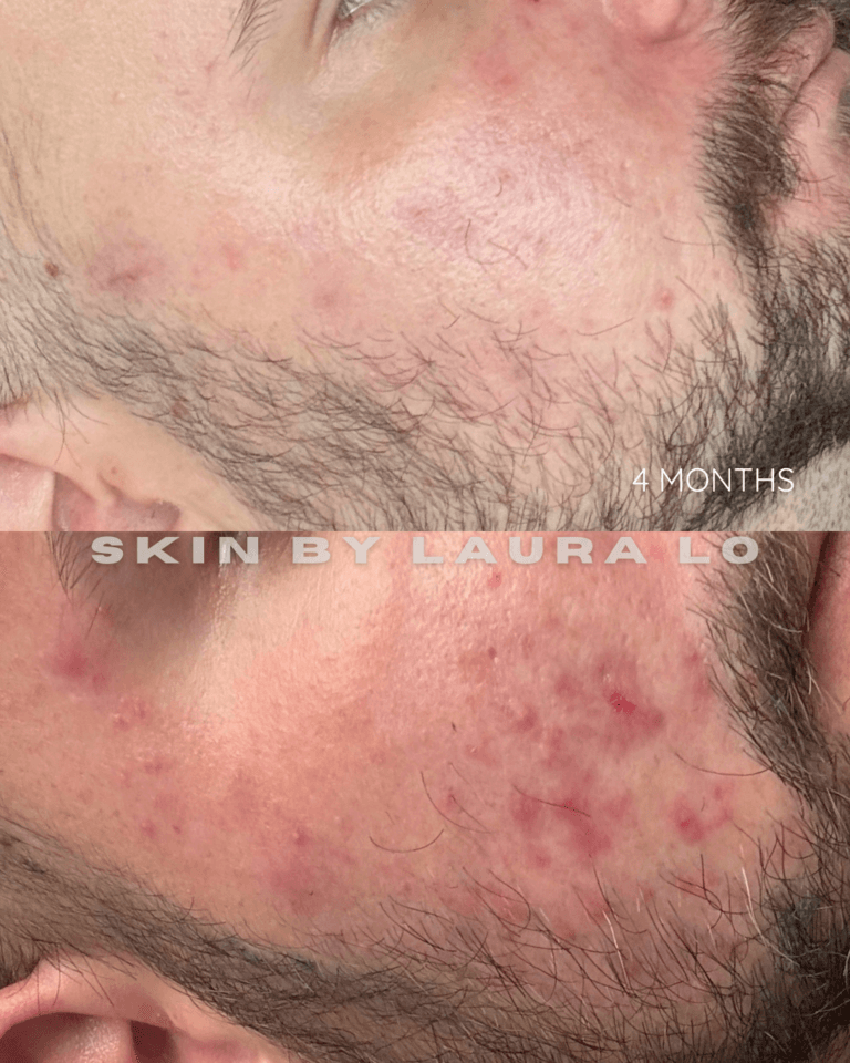 Longer Before and Afters (11)