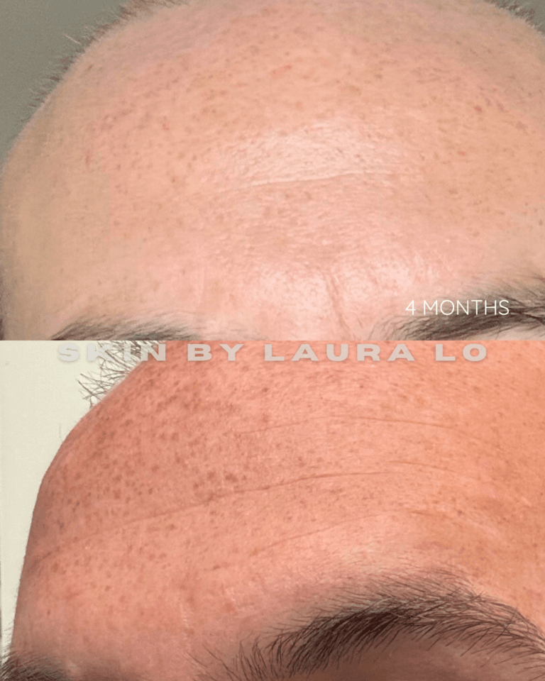 Longer Before and Afters (12)