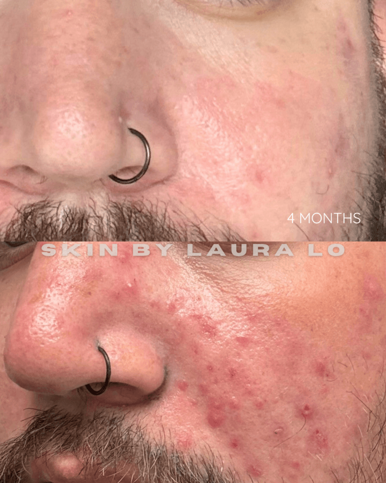 Longer Before and Afters (13)