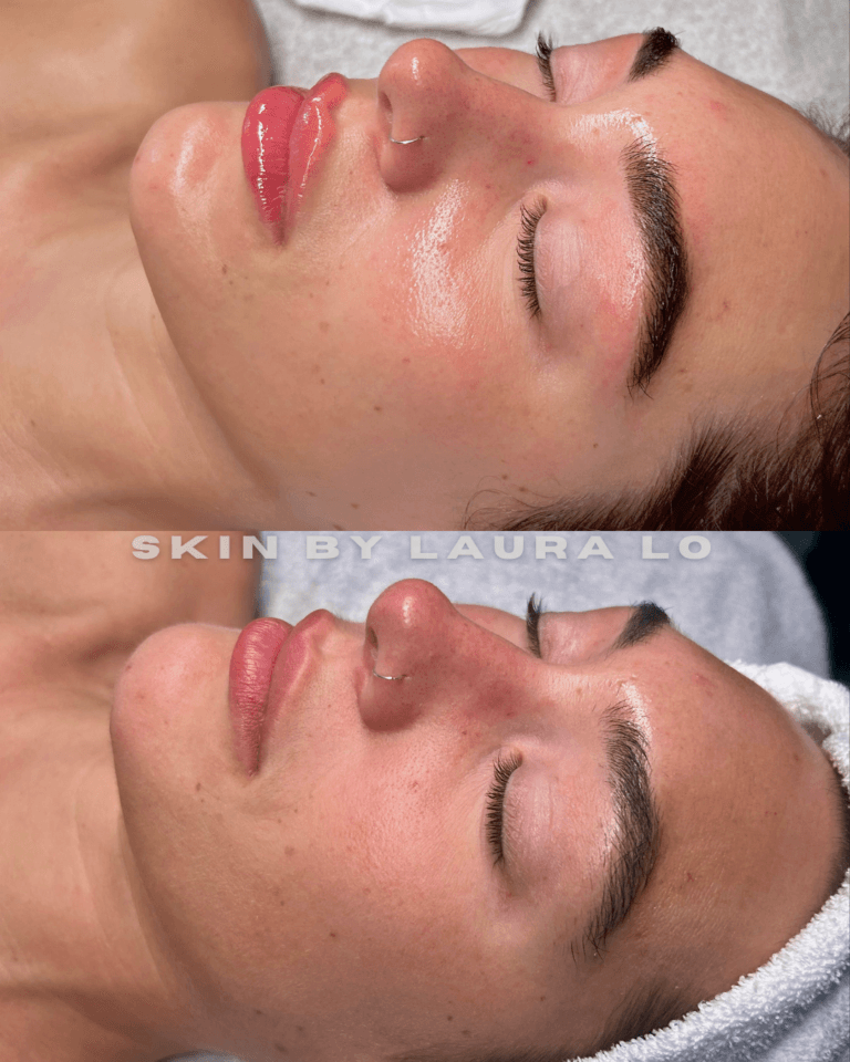 Longer Before and Afters (14)