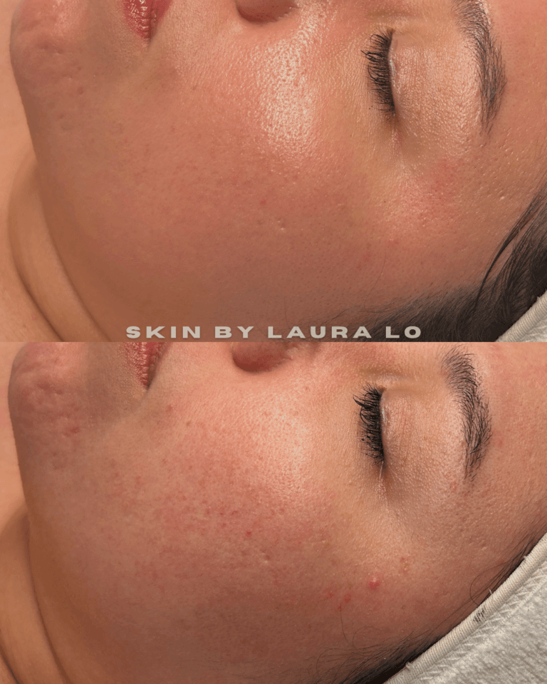 Longer Before and Afters (16)