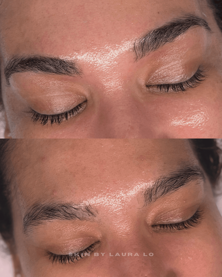 Longer Before and Afters (17)