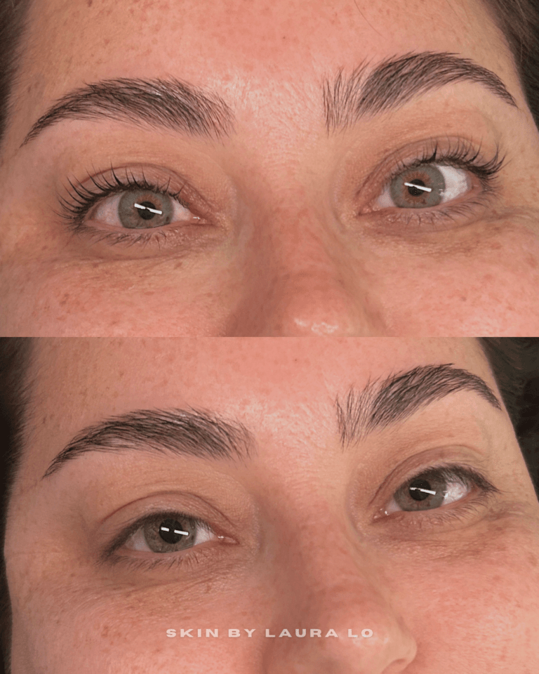 Longer Before and Afters (2)