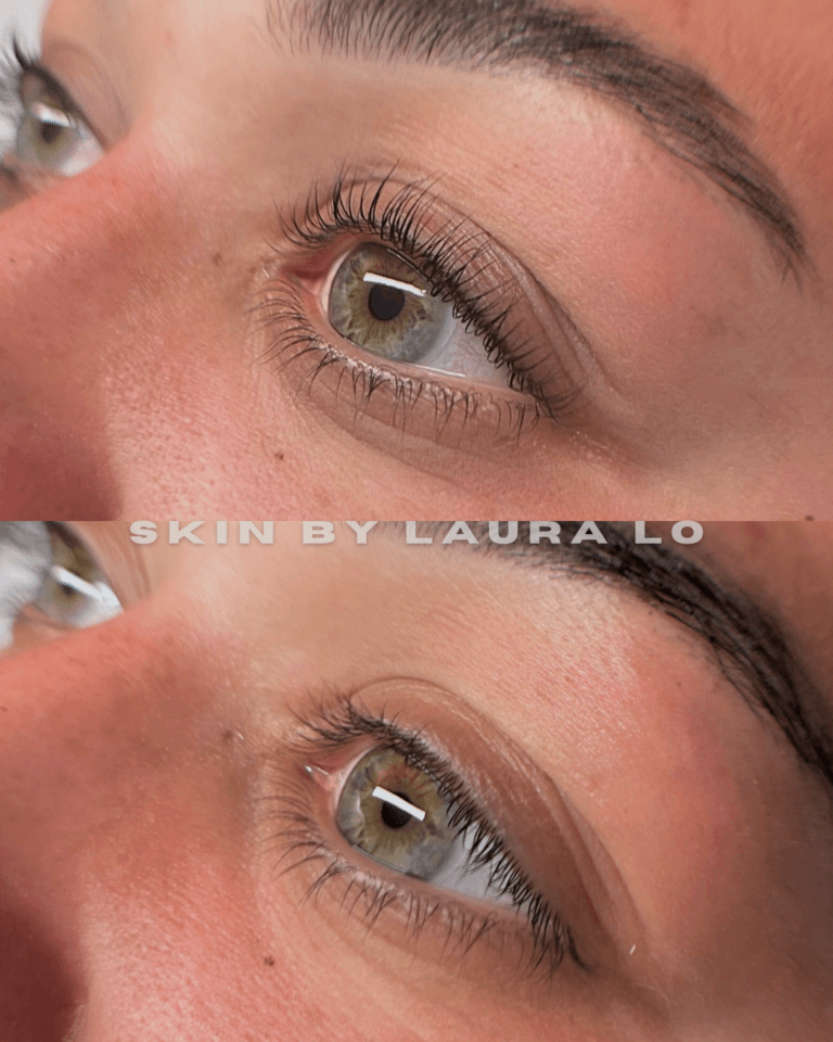 Longer Before and Afters (3)