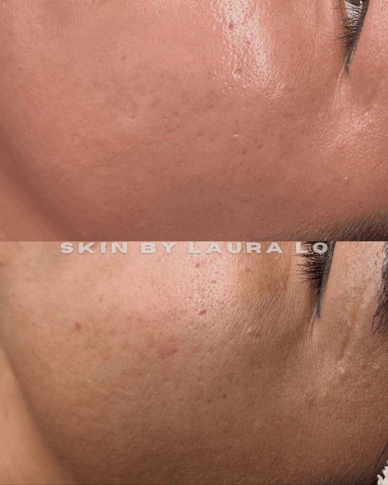 Longer Before and Afters (4)