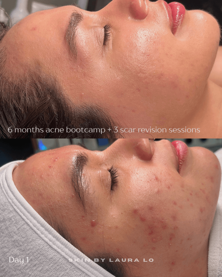 Longer Before and Afters (5)