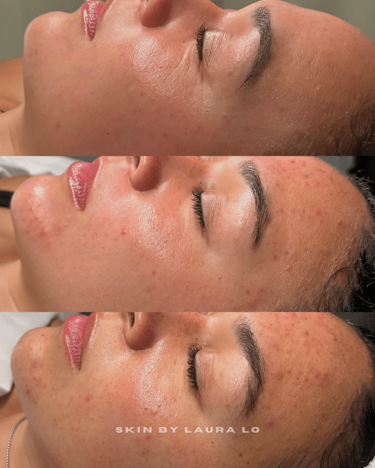 Longer Before and Afters (7)