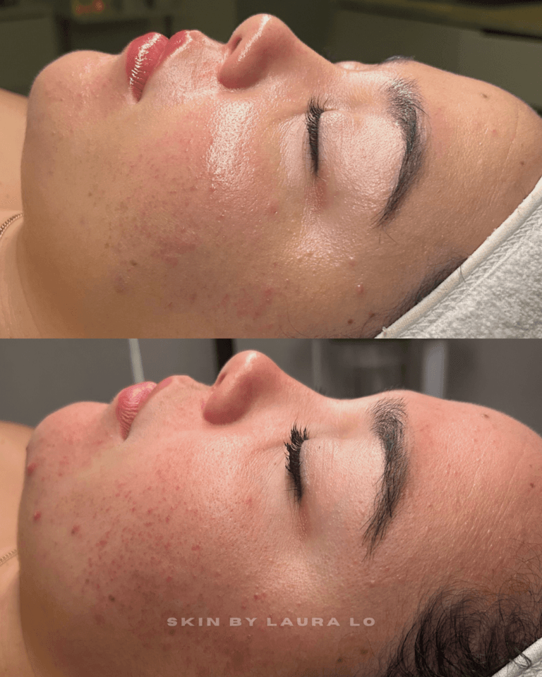 Longer Before and Afters