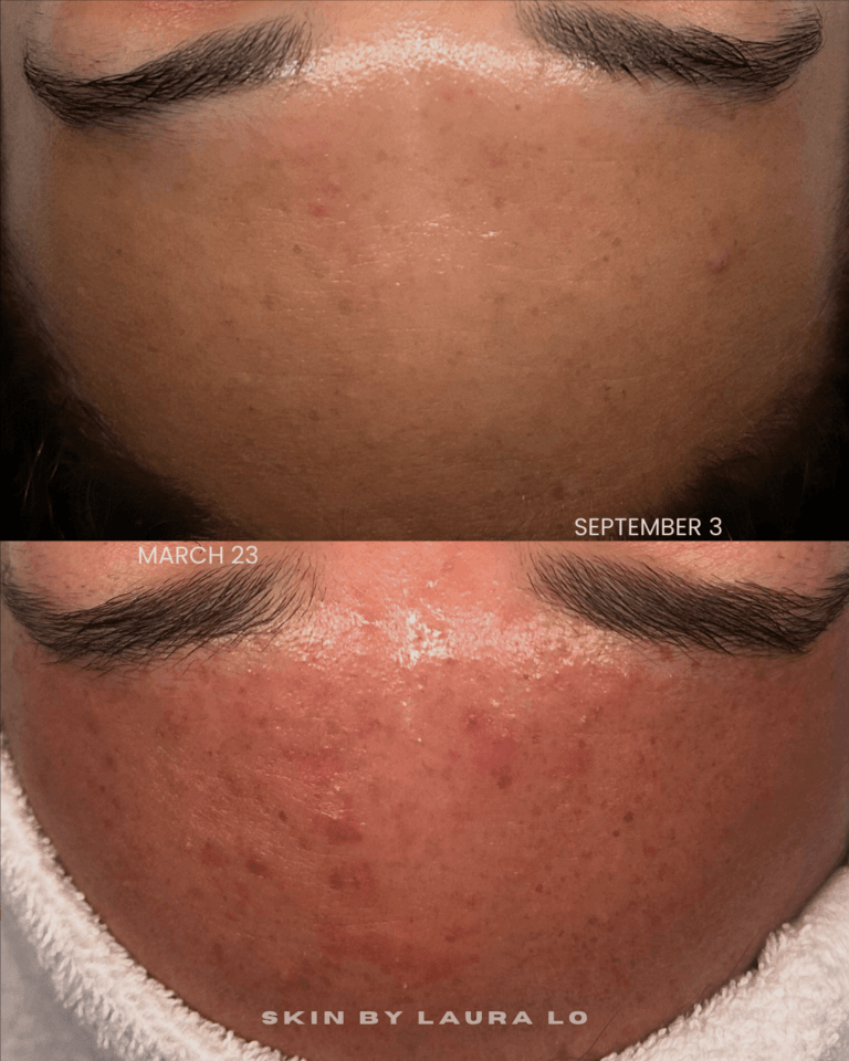 Longer Before and Afters (8)