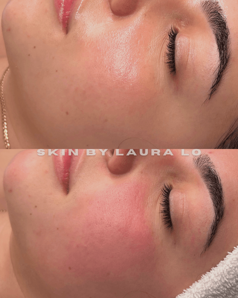 Longer Before and Afters (9)